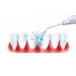 Irrigateur oral: que faut-il rechercher lors du choix